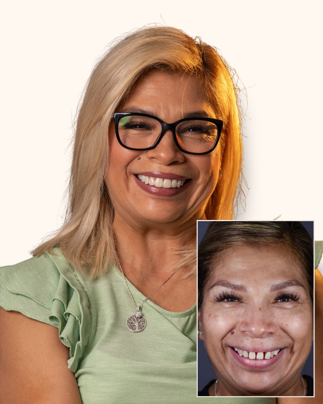 Clara Sotero Cano — Antes y Después