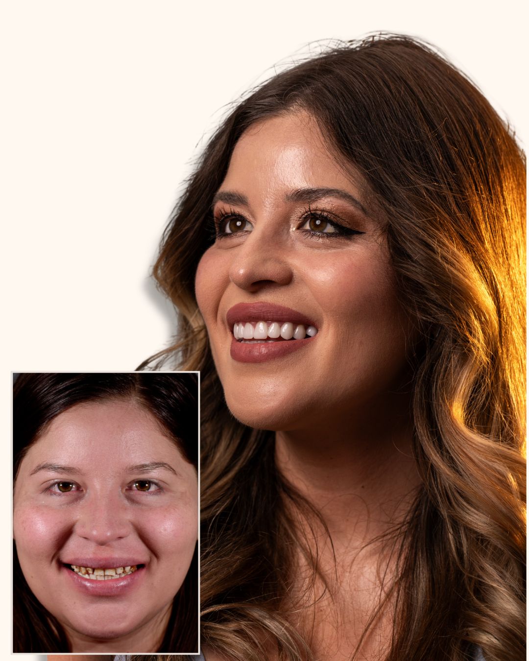 Yessi Robles — Antes y Después