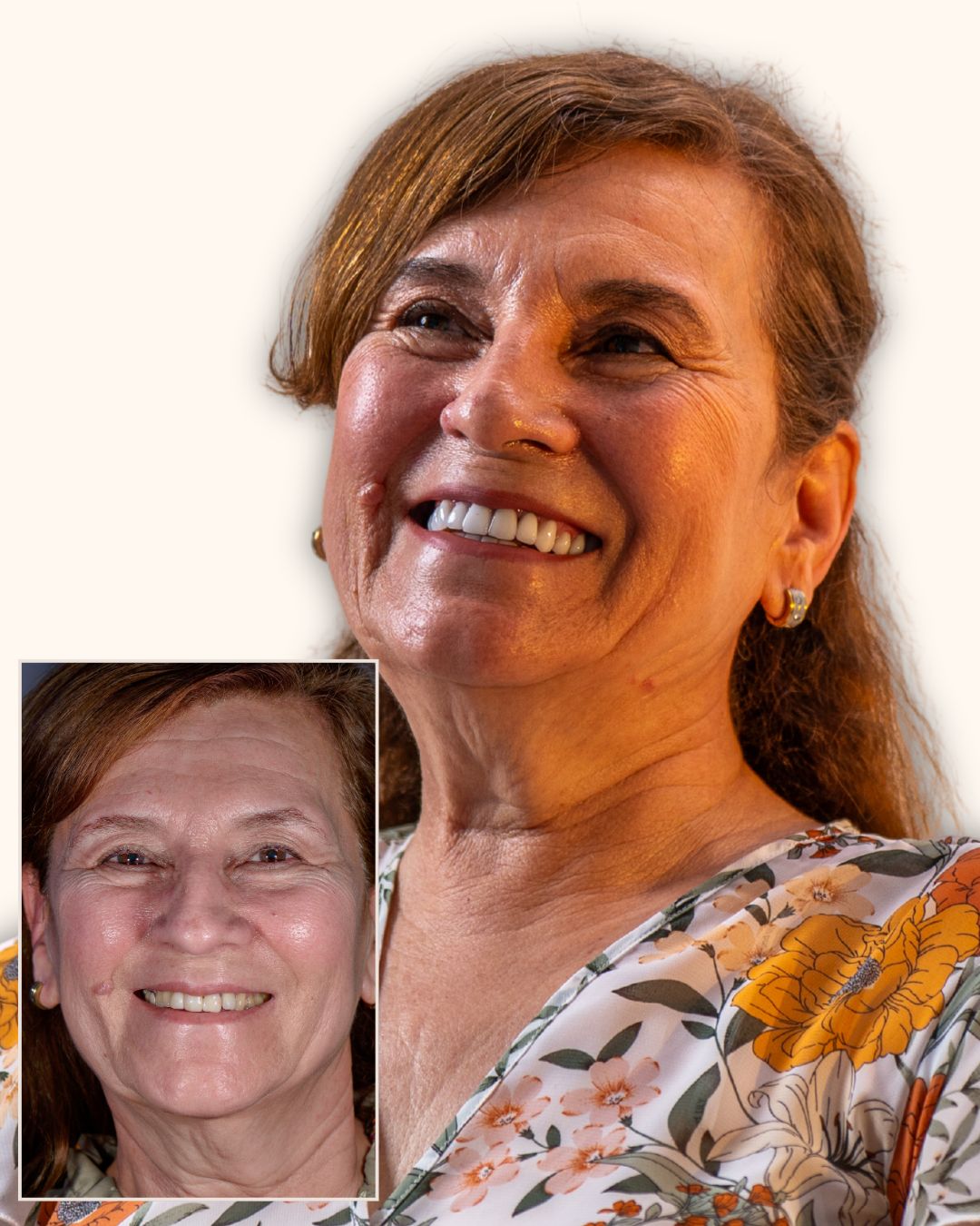 Zaida Patricia Mercado — Antes y Después