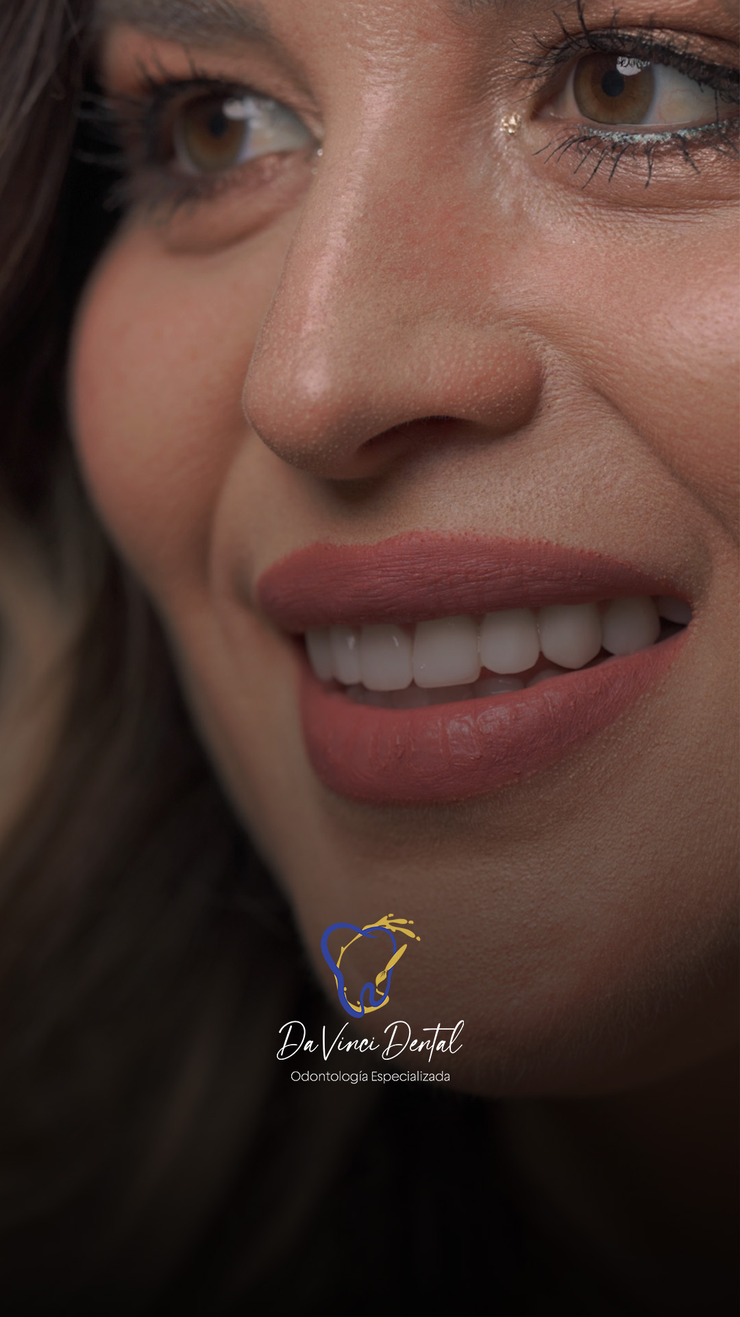 Yessi Chaparro. — Carillas Dentales